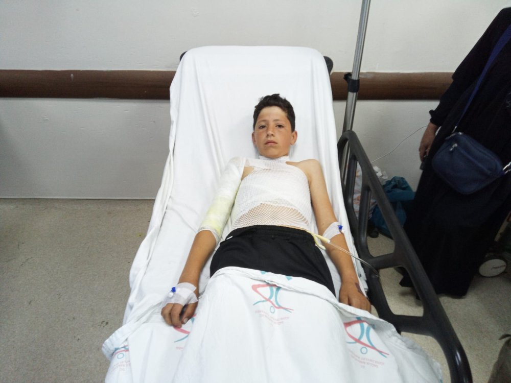 Hayvan otlatırken yıldırım isabet eden 2 kardeş yaralandı; 20 koyun öldü