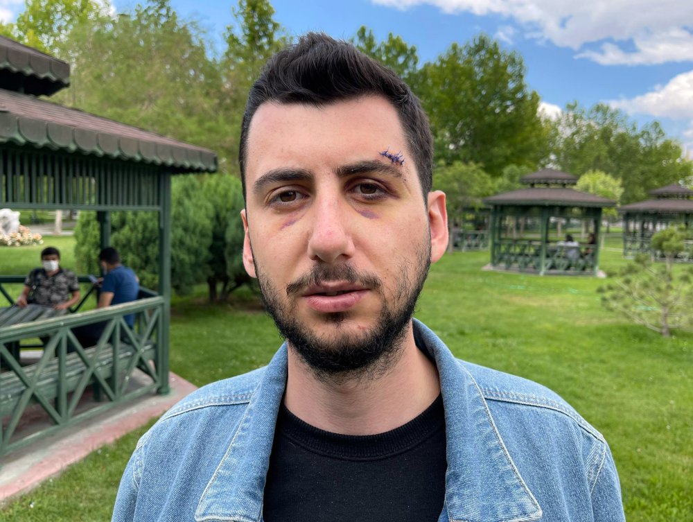 Konya'da eski sevgilisinin arkadaşına muştayla saldırıp çenesini kıran sanığa, 'iyi hal' indirimi