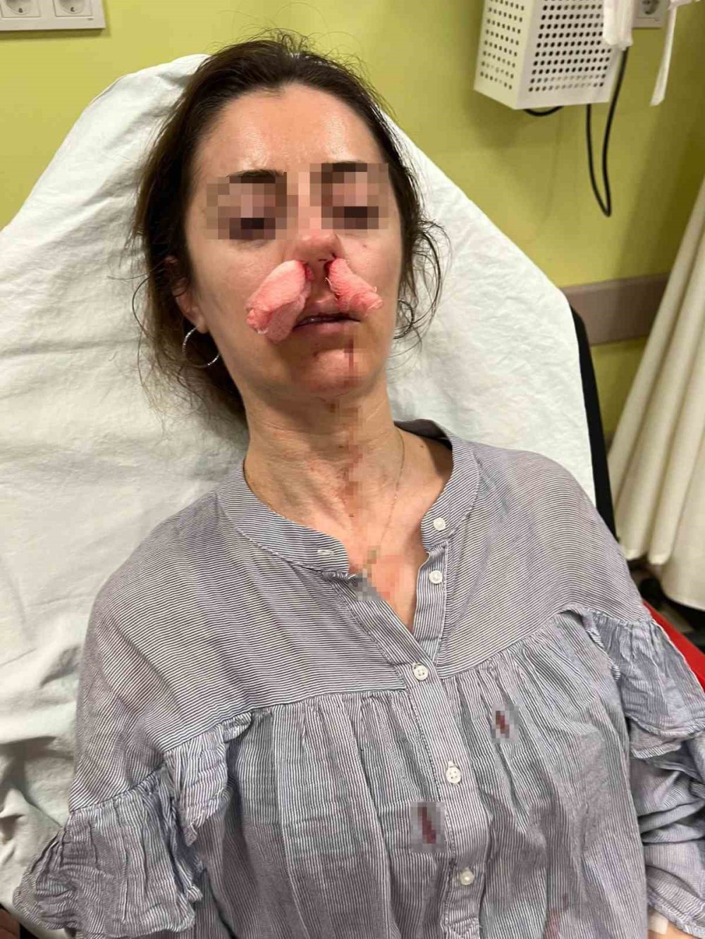 Kocasının sevgilisine benzettiği kadını darbetti