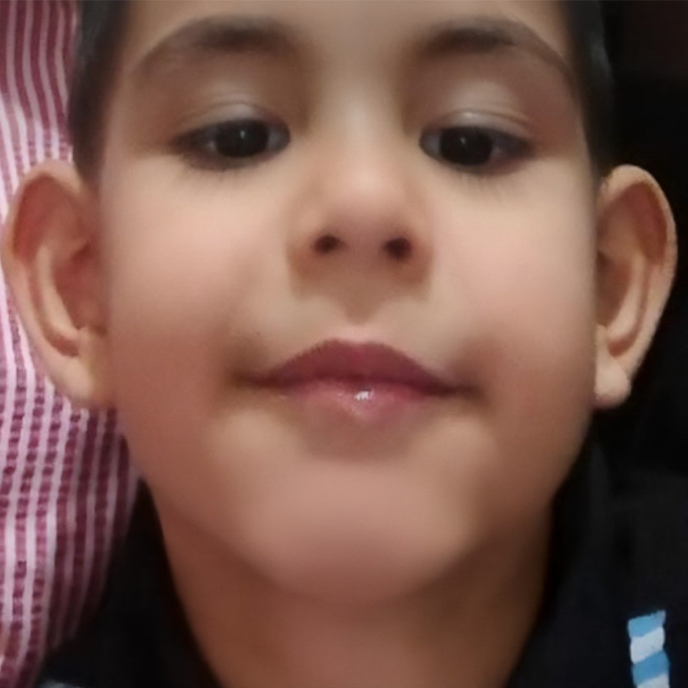 Minik Çınar, yaşam savaşını kaybetti