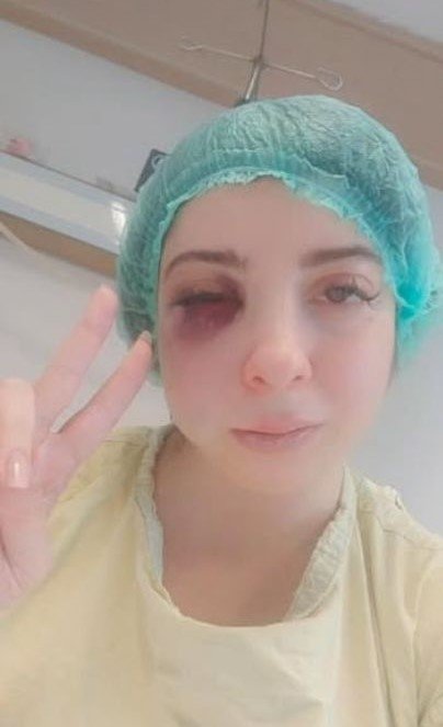 Sokak ortasında darbedildi... Artık yüzümün sol tarafını hissetmiyorum