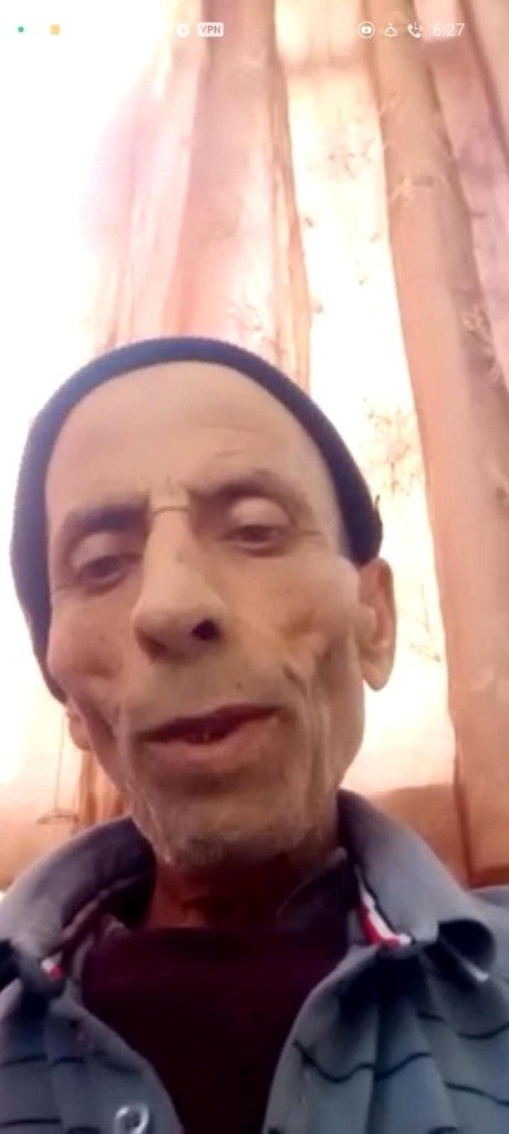 Gazzeli doktorun Türkiye'ye getirmek istediği kanser hastası babası öldü