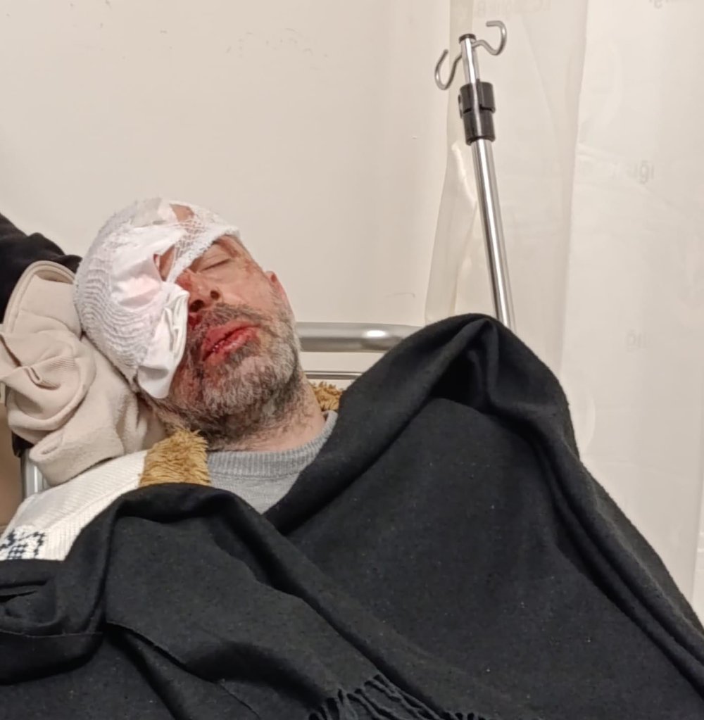 Köpeklerden kaçarken bisikletten düşüp, yaralandı