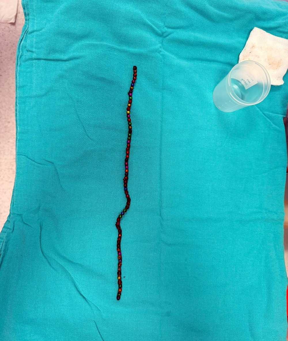 Doktorları bile şoke eden vaka!