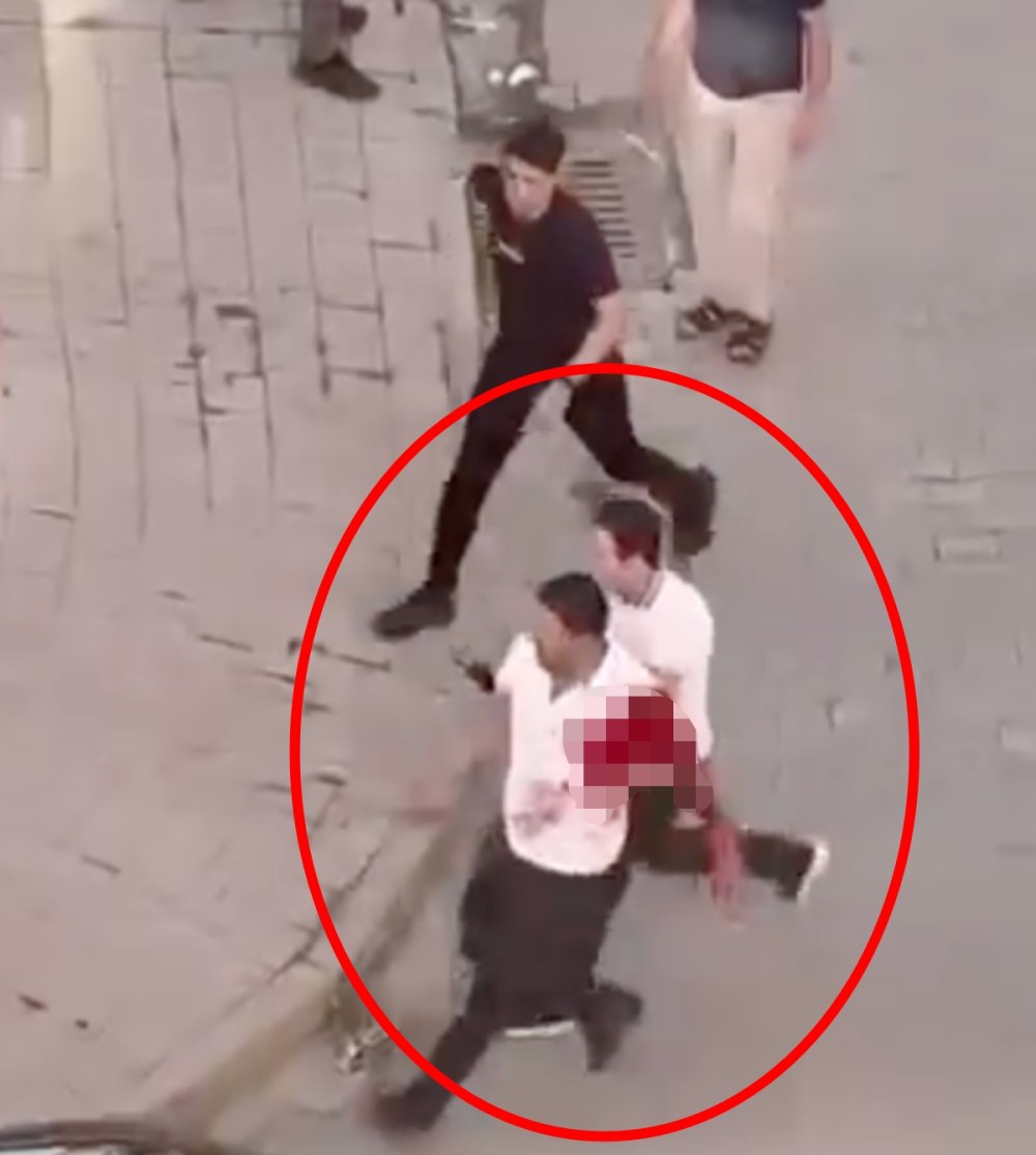 Çocukların kavgasına ailelerin de karıştığı bıçaklı kavga kan aktı