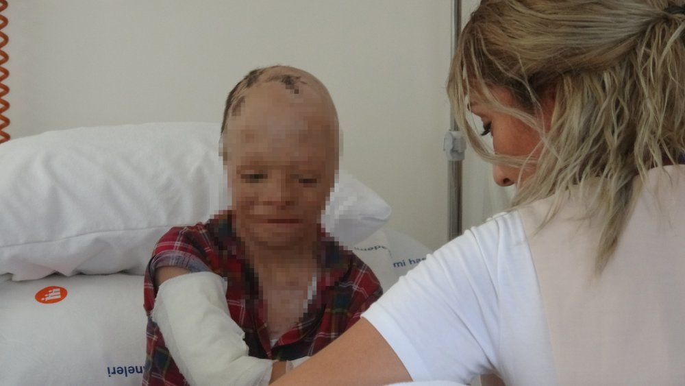 Babası ve 3 kardeşinin öldüğü yangında yaralanan Eymen'e Konya şifa oldu