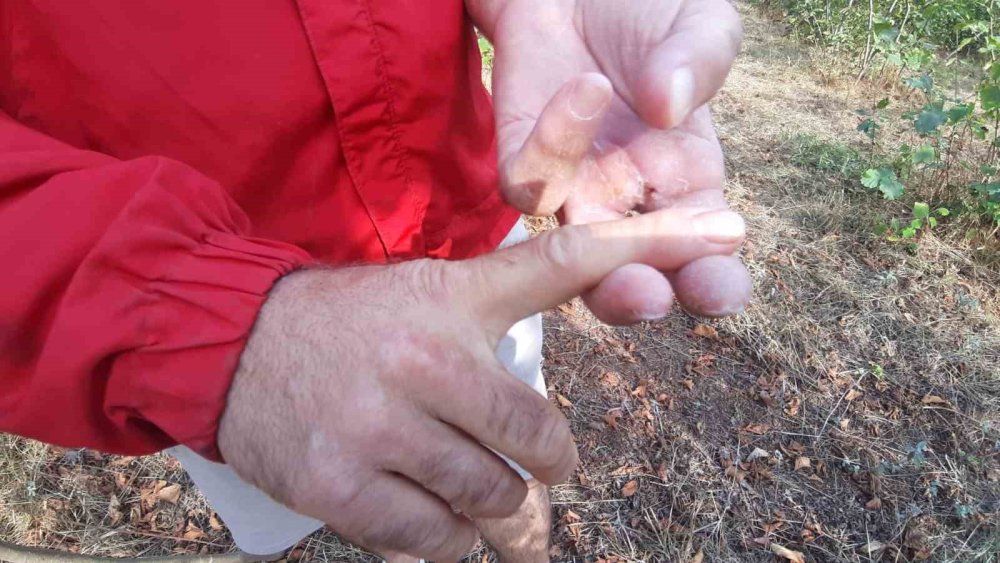 Ayının saldırısına uğrayan çiftçi dehşet anlarını anlattı