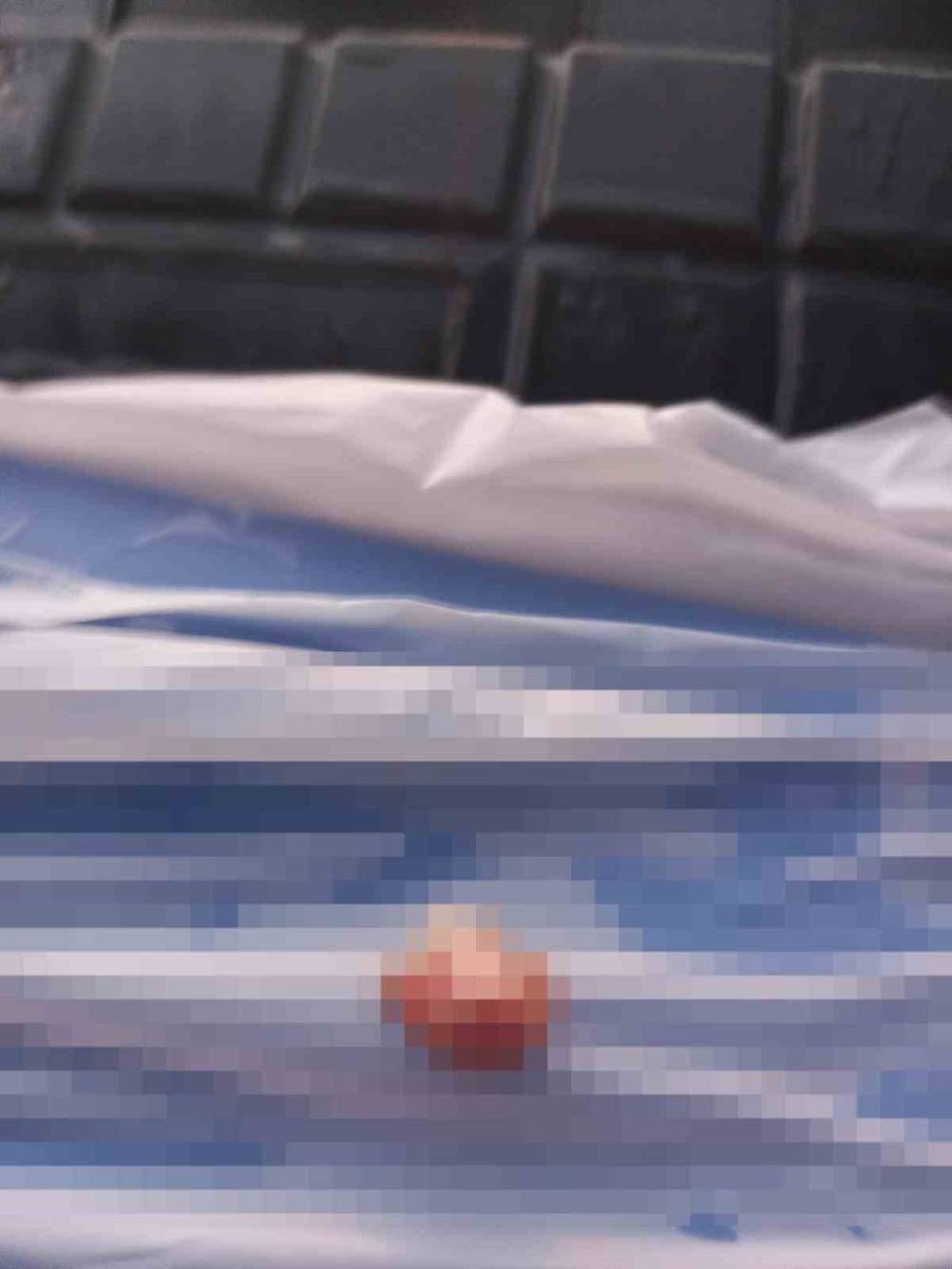 İlkokulda dehşet... Çocuğun parmağı koptu, ders devam etti