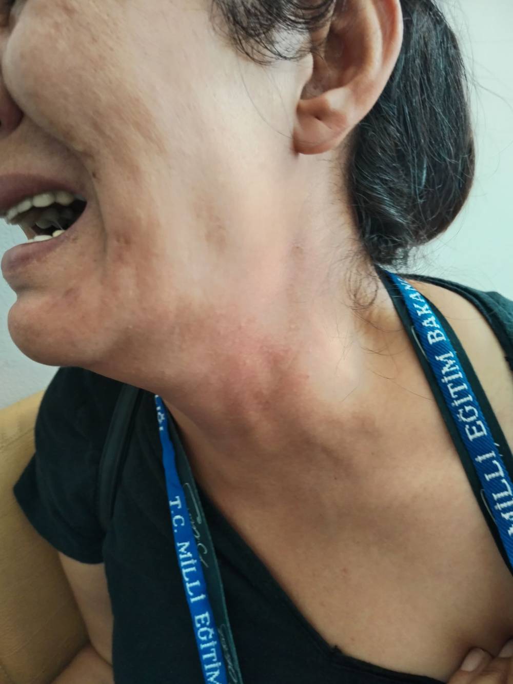 Öğretmene tokat atan veli tutuklandı