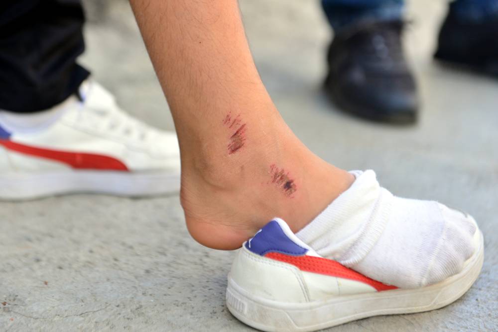 Kovaladığı çocuğu ayak bileğinden tutup yere fırlatan şüpheli tutuklandı