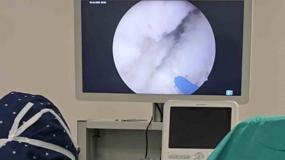 Prostata kesin çözüm... 400 grama kadar prostat güvenle alınabiliyor