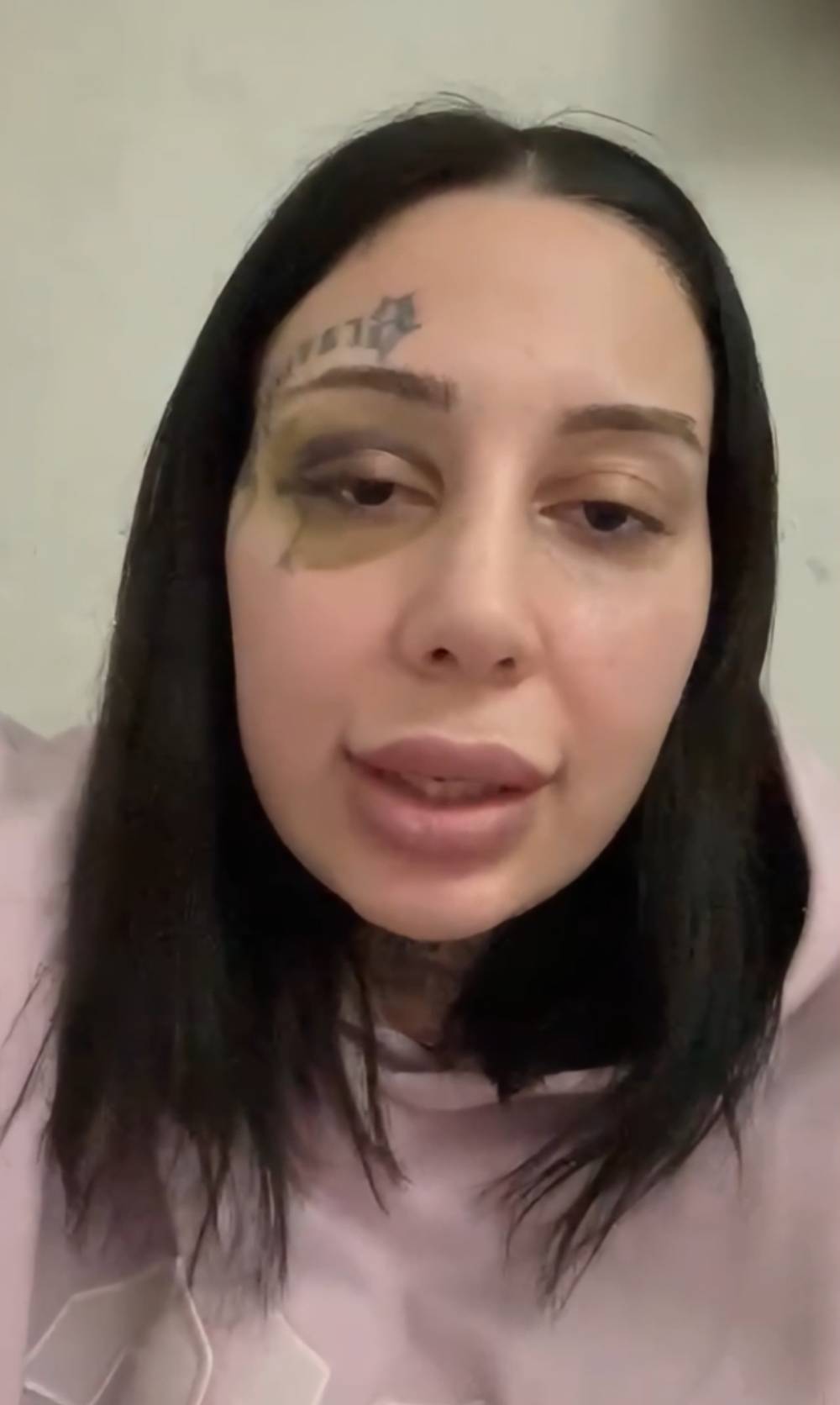 Eşini darbeden Bilal: Burun estetiği yaptırıp benden boşanmak istedi