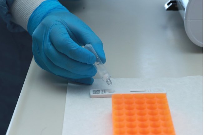 koronavirus-testleri-15-dakikada-sonuc-verecek-3.jpg